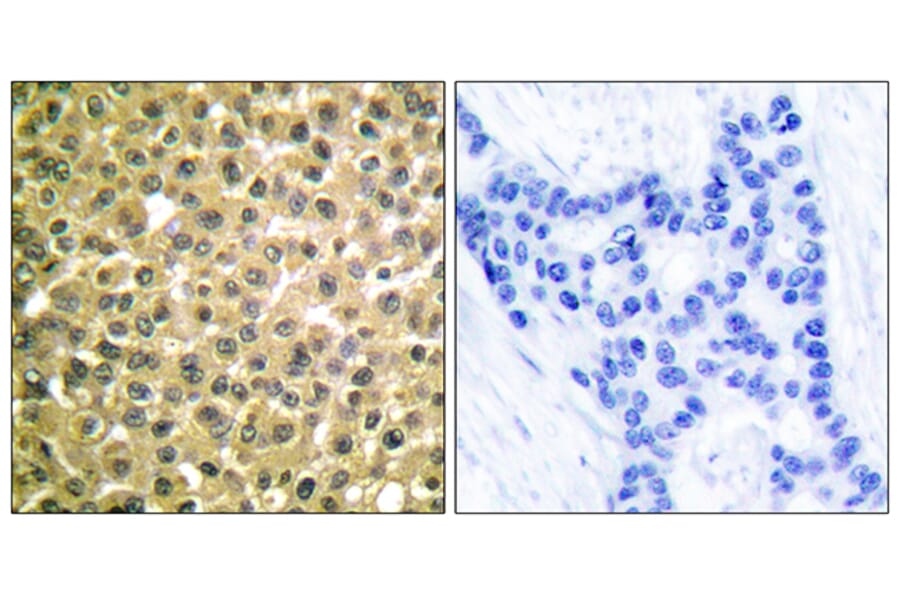 Immunohistochemistry - Anti-Retinoic Acid Receptor beta Antibody (C0315) - Antibodies.com