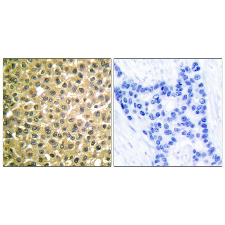 Immunohistochemistry - Anti-Retinoic Acid Receptor beta Antibody (C0315) - Antibodies.com