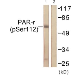 Western Blot - Anti-PPAR-gamma (phospho Ser112) Antibody (A0557) - Antibodies.com