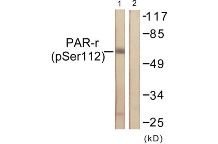 Western Blot - Anti-PPAR-gamma (phospho Ser112) Antibody (A0557) - Antibodies.com