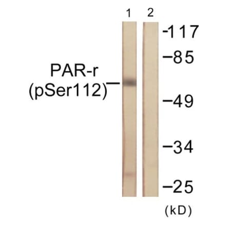 Western Blot - Anti-PPAR-gamma (phospho Ser112) Antibody (A0557) - Antibodies.com