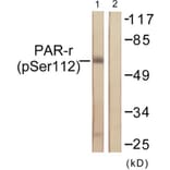 Western Blot - Anti-PPAR-gamma (phospho Ser112) Antibody (A0557) - Antibodies.com