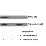 Western Blot - Anti-PPAR-gamma (phospho Ser112) Antibody (A0557) - Antibodies.com