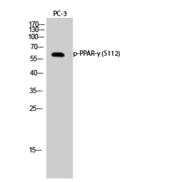 Western Blot - Anti-PPAR-gamma (phospho Ser112) Antibody (A0557) - Antibodies.com