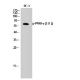 Western Blot - Anti-PPAR-gamma (phospho Ser112) Antibody (A0557) - Antibodies.com