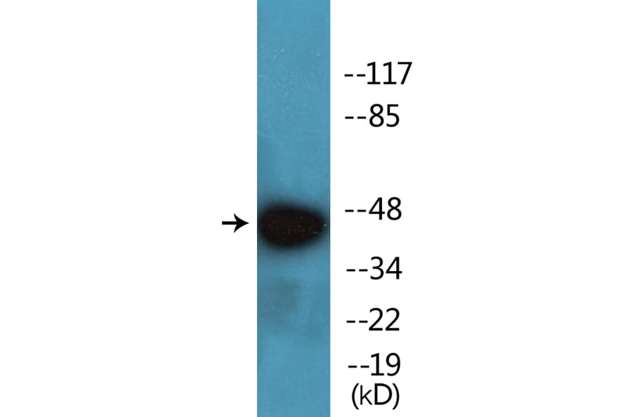 Western Blot - Anti-PKA-R2beta (phospho Ser113) Antibody (P12-1165) - Antibodies.com