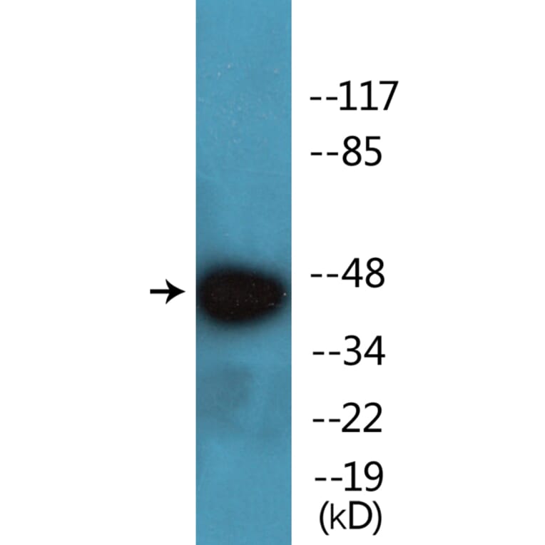 Western Blot - Anti-PKA-R2beta (phospho Ser113) Antibody (P12-1165) - Antibodies.com
