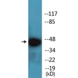 Western Blot - Anti-PKA-R2beta (phospho Ser113) Antibody (P12-1165) - Antibodies.com