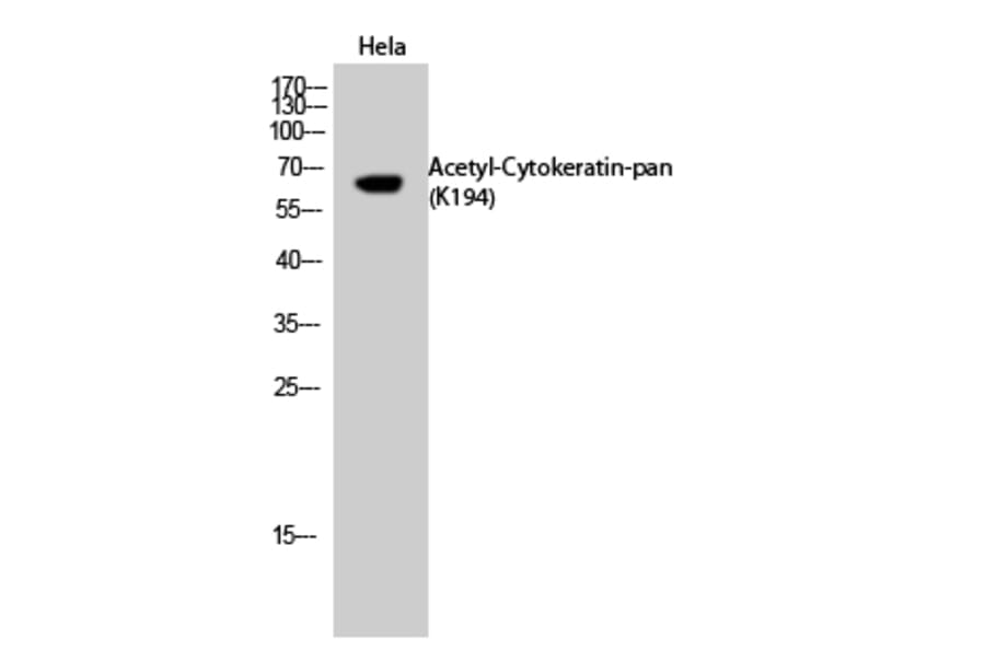 Western Blot - Anti-Keratin-pan (acetyl Lys194) Antibody (D12137) - Antibodies.com