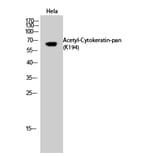 Western Blot - Anti-Keratin-pan (acetyl Lys194) Antibody (D12137) - Antibodies.com