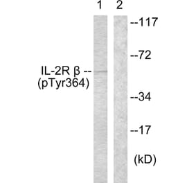 Western Blot - Anti-IL-2R beta (phospho Tyr364) Antibody (A1060) - Antibodies.com