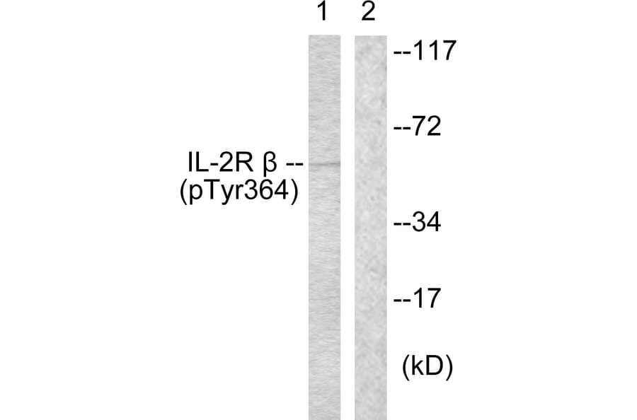 Western Blot - Anti-IL-2R beta (phospho Tyr364) Antibody (A1060) - Antibodies.com