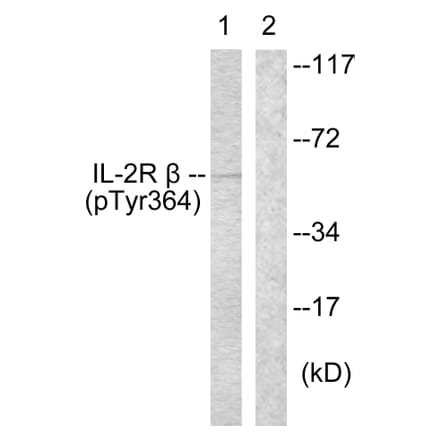 Western Blot - Anti-IL-2R beta (phospho Tyr364) Antibody (A1060) - Antibodies.com