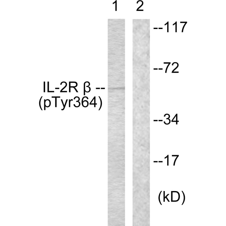 Western Blot - Anti-IL-2R beta (phospho Tyr364) Antibody (A1060) - Antibodies.com