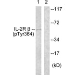 Western Blot - Anti-IL-2R beta (phospho Tyr364) Antibody (A1060) - Antibodies.com