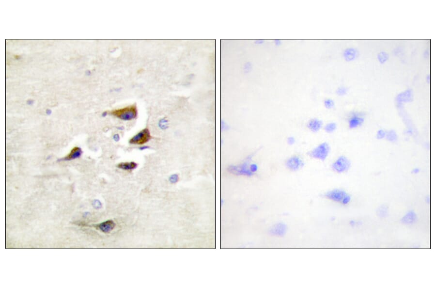 Immunohistochemistry - Anti-CaMK2 alpha + beta + delta Antibody (B0005) - Antibodies.com