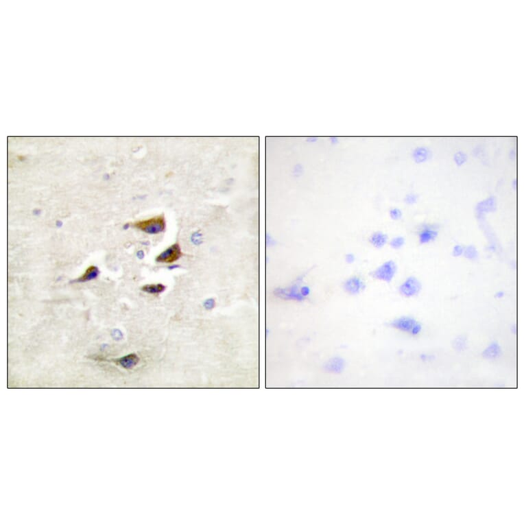 Immunohistochemistry - Anti-CaMK2 alpha + beta + delta Antibody (B0005) - Antibodies.com