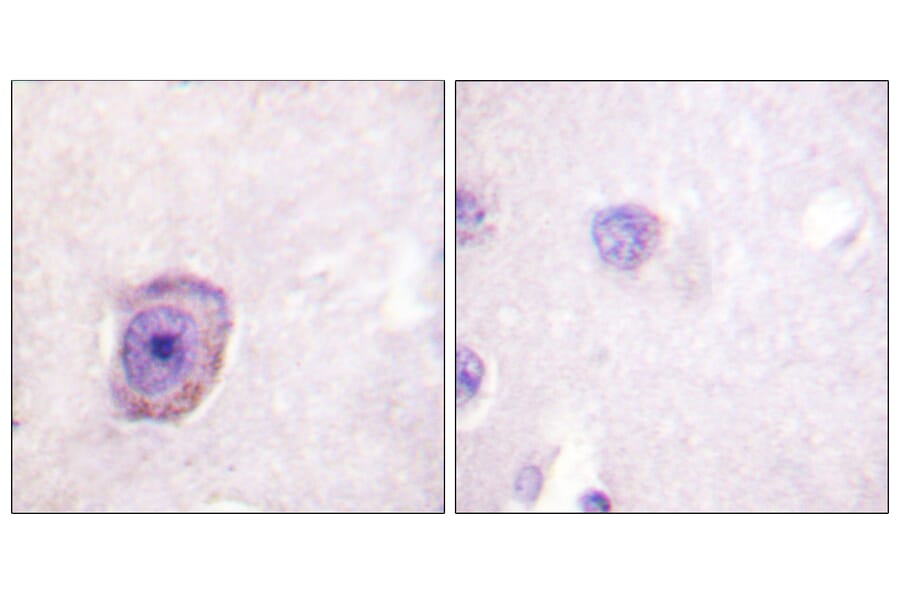 Immunohistochemistry - Anti-Rhodopsin (phospho Ser334) Antibody (A0569) - Antibodies.com
