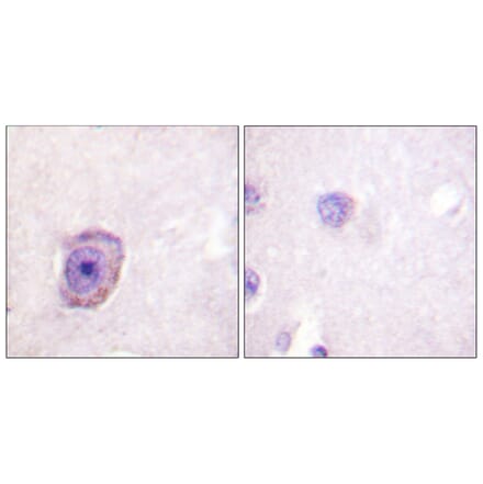 Immunohistochemistry - Anti-Rhodopsin (phospho Ser334) Antibody (A0569) - Antibodies.com