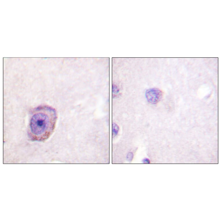 Immunohistochemistry - Anti-Rhodopsin (phospho Ser334) Antibody (A0569) - Antibodies.com