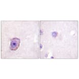 Immunohistochemistry - Anti-Rhodopsin (phospho Ser334) Antibody (A0569) - Antibodies.com