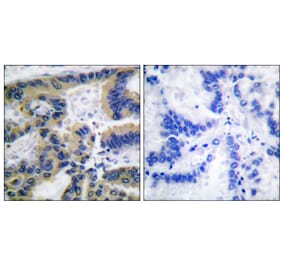 Immunohistochemistry - Anti-Caspase 7 (cleaved Asp198) Antibody (L0109) - Antibodies.com