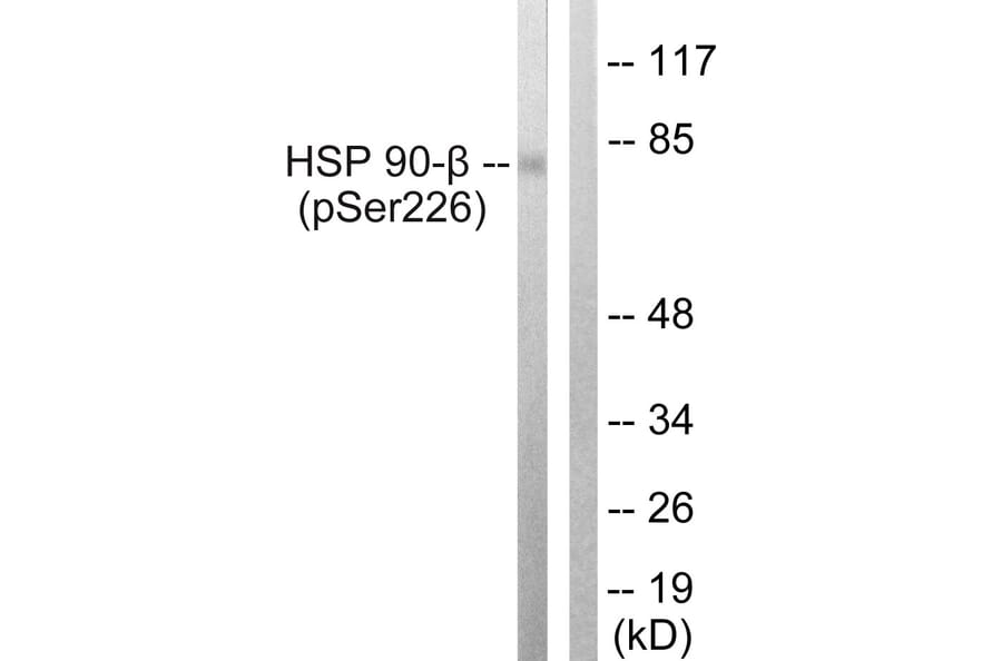 Western Blot - Anti-HSP90B (phospho Ser226) Antibody (A1210) - Antibodies.com
