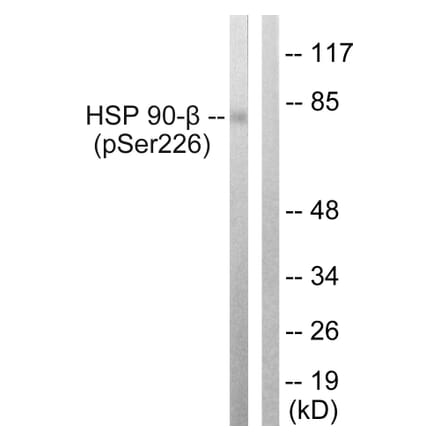 Western Blot - Anti-HSP90B (phospho Ser226) Antibody (A1210) - Antibodies.com
