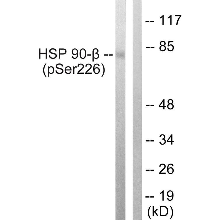 Western Blot - Anti-HSP90B (phospho Ser226) Antibody (A1210) - Antibodies.com