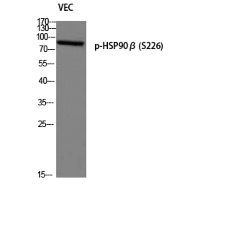 Western Blot - Anti-HSP90B (phospho Ser226) Antibody (A1210) - Antibodies.com