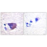 Immunohistochemistry - Anti-KCNB1 (phospho Ser567) Antibody (A1086) - Antibodies.com