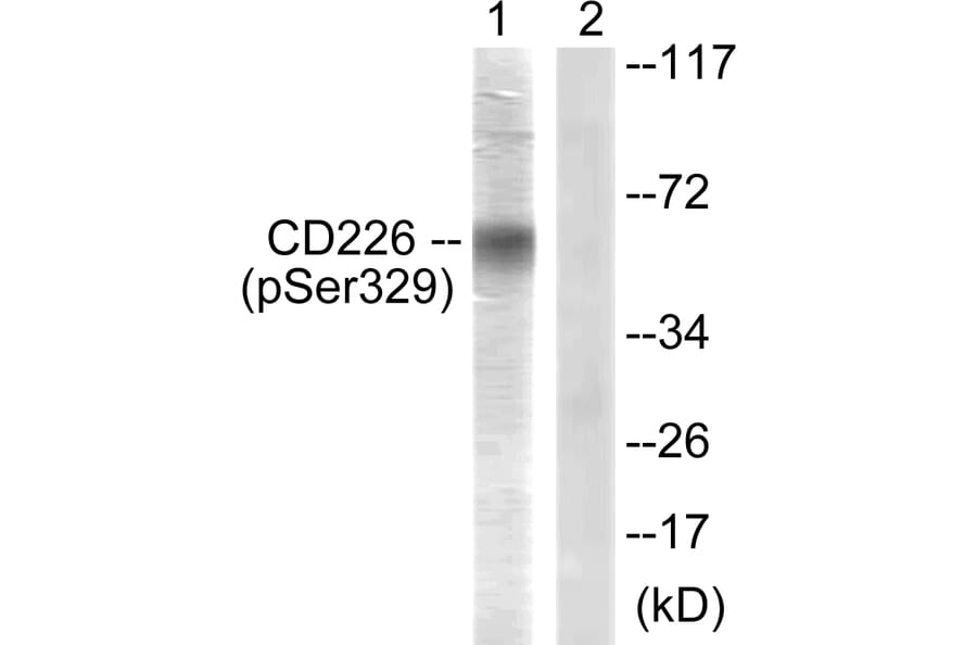 Western Blot - Anti-CD226 (phospho Ser329) Antibody (A0843) - Antibodies.com