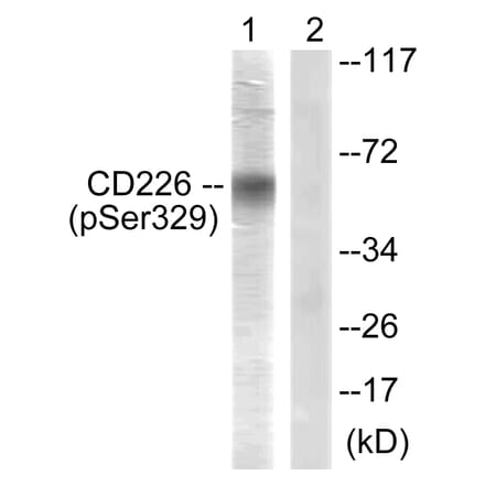 Western Blot - Anti-CD226 (phospho Ser329) Antibody (A0843) - Antibodies.com