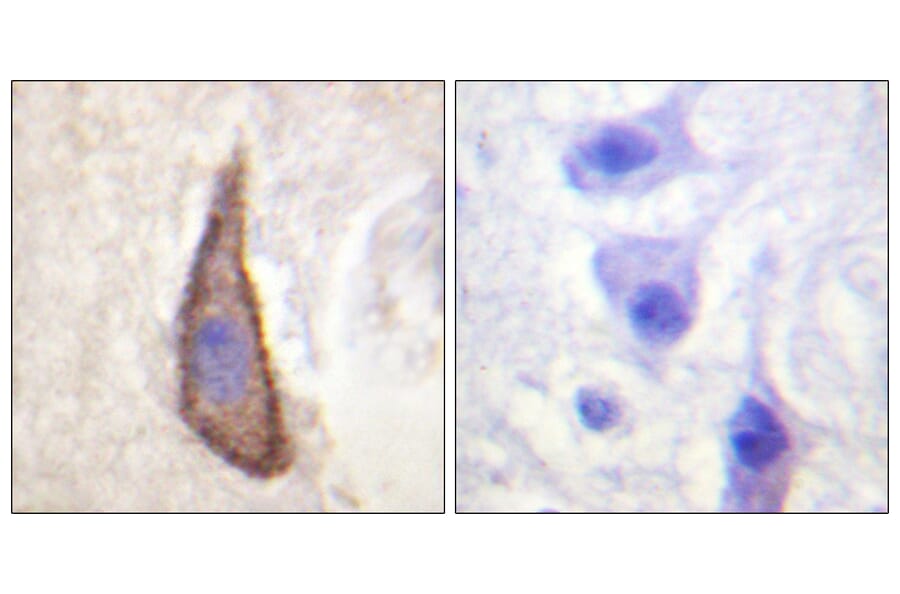 Immunohistochemistry - Anti-CD226 (phospho Ser329) Antibody (A0843) - Antibodies.com