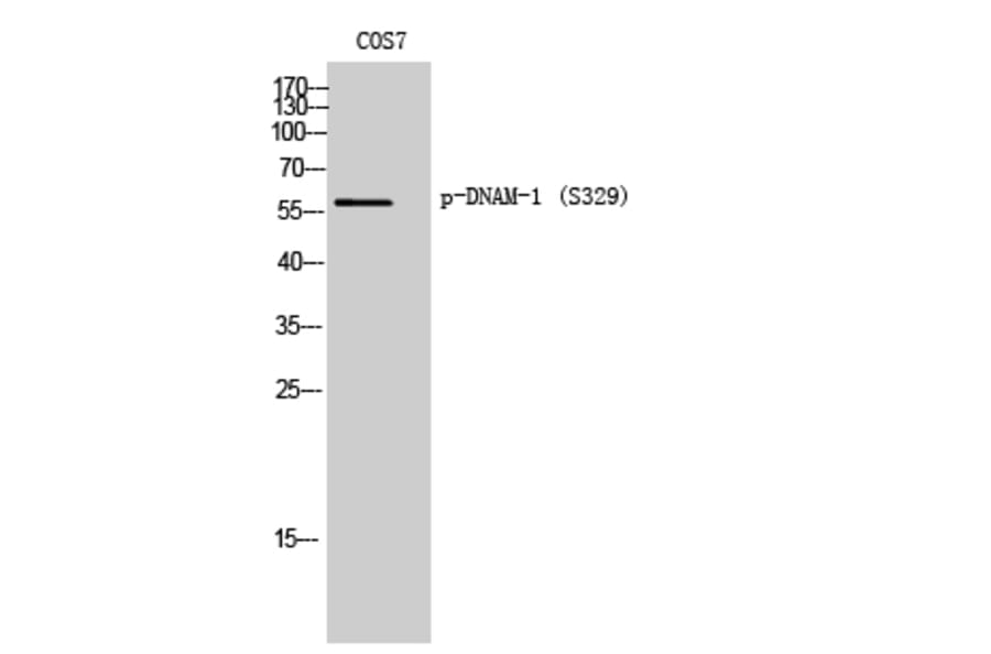 Western Blot - Anti-CD226 (phospho Ser329) Antibody (A0843) - Antibodies.com