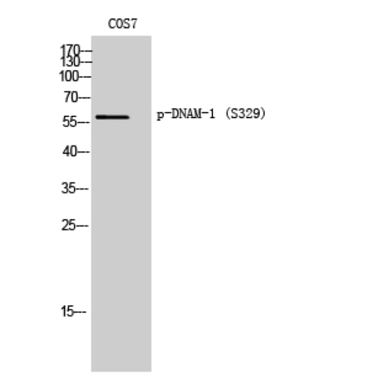 Western Blot - Anti-CD226 (phospho Ser329) Antibody (A0843) - Antibodies.com