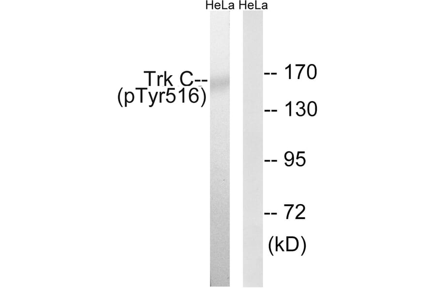 Western Blot - Anti-Trk C (phospho Tyr516) Antibody (A8196) - Antibodies.com