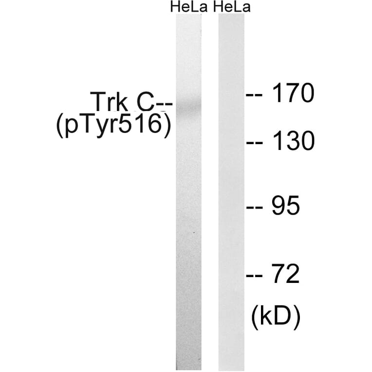 Western Blot - Anti-Trk C (phospho Tyr516) Antibody (A8196) - Antibodies.com