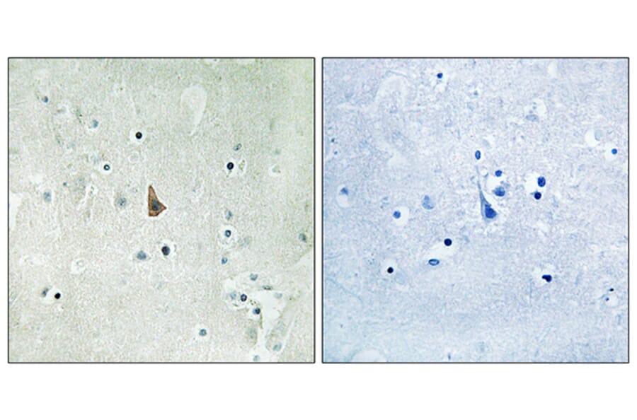 Immunohistochemistry - Anti-Trk C (phospho Tyr516) Antibody (A8196) - Antibodies.com