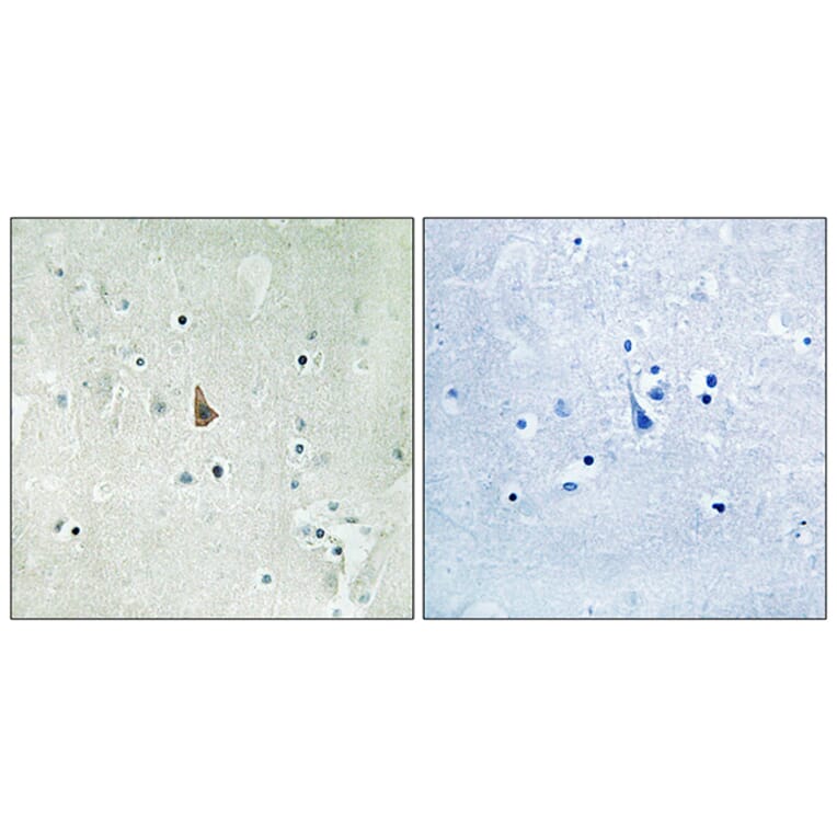 Immunohistochemistry - Anti-Trk C (phospho Tyr516) Antibody (A8196) - Antibodies.com