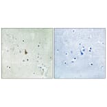 Immunohistochemistry - Anti-Trk C (phospho Tyr516) Antibody (A8196) - Antibodies.com