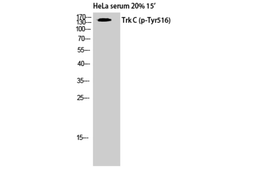 Western Blot - Anti-Trk C (phospho Tyr516) Antibody (A8196) - Antibodies.com