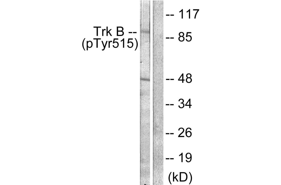 Western Blot - Anti-Trk B (phospho Tyr515) Antibody (A0035) - Antibodies.com