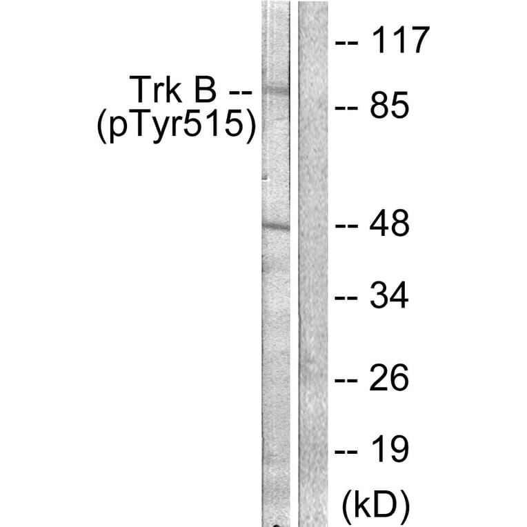 Western Blot - Anti-Trk B (phospho Tyr515) Antibody (A0035) - Antibodies.com