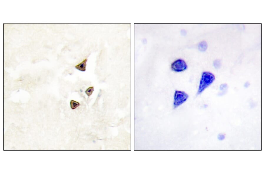 Immunohistochemistry - Anti-Trk B (phospho Tyr515) Antibody (A0035) - Antibodies.com