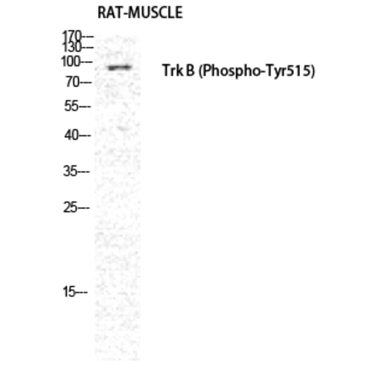 Western Blot - Anti-Trk B (phospho Tyr515) Antibody (A0035) - Antibodies.com