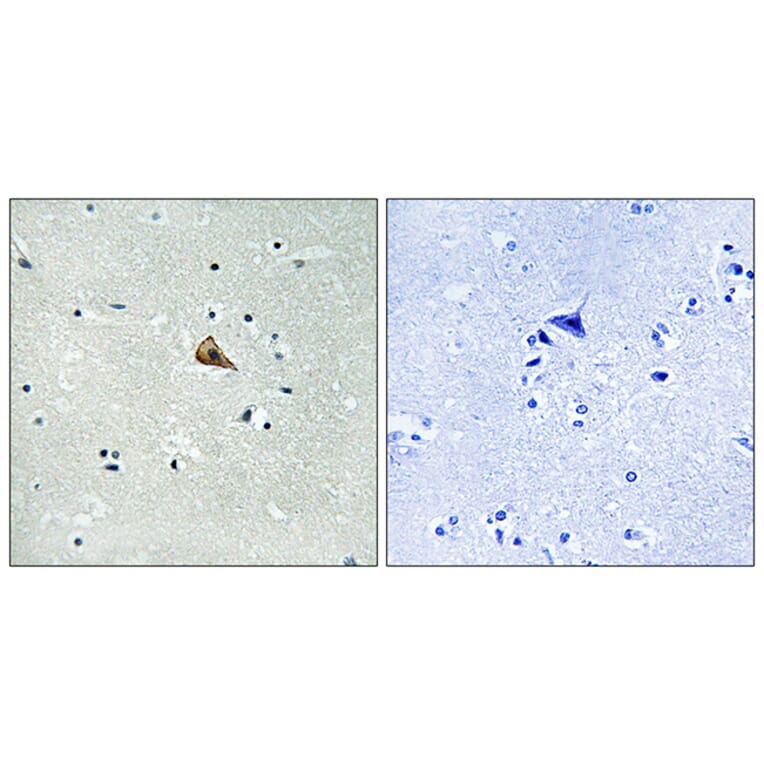 Immunohistochemistry - Anti-Trk A (phospho Tyr701) Antibody (A8070) - Antibodies.com