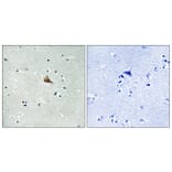 Immunohistochemistry - Anti-Trk A (phospho Tyr701) Antibody (A8070) - Antibodies.com