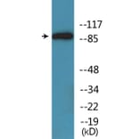 Western Blot - Anti-Trk A (phospho Tyr701) Antibody (P12-1194) - Antibodies.com