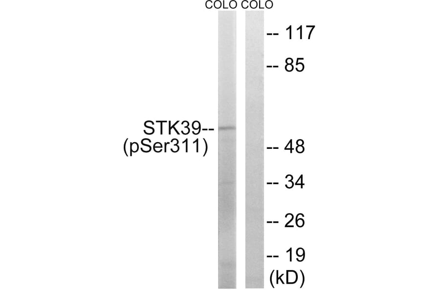Western Blot - Anti-STK39 (phospho Ser311) Antibody (A8188) - Antibodies.com